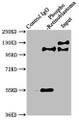 Immunoprecipitating Phospho-RB1 in Hela whole cell lysate; Lane 1: Rabbit control IgG(1ug)instead of CAC12485 in Hela whole cell lysate.For western blotting,a HRP-conjugated Protein G antibody was used as the secondary antibody (1/2000); Lane 2: CAC12485(3ug)+ Hela whole cell lysate(1mg); Lane 3: Hela whole cell lysate (20ug)