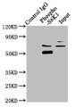 Immunoprecipitating Phospho-RPS6KB1 in Hela whole cell lysate; Lane 1: Rabbit control IgG(1ug)instead of CAC12491 in Hela whole cell lysate.For western blotting,a HRP-conjugated Protein G antibody was used as the secondary antibody (1/2000); Lane 2: CAC12491(3ug)+ Hela whole cell lysate(1mg); Lane 3: Hela whole cell lysate (20ug)