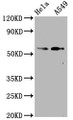 Western Blot; Positive WB detected in Hela whole cell lysate,A549 whole cell lysate; All lanes Phospho-SMAD2 antibody at 1.07ug/ml; Secondary; Goat polyclonal to rabbit IgG at 1/50000 dilution; Predicted band size: 58 KDa; Observed band size: 58 KDa