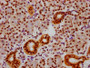 IHC image of CAC12495 diluted at 1:100 and staining in paraffin-embedded human pancreatic tissue performed on a Leica BondTM system. After dewaxing and hydration, antigen retrieval was mediated by high pressure in a citrate buffer (pH 6.0). Section was blocked with 10% normal goat serum 30min at RT. Then primary antibody (1% BSA) was incubated at 4? overnight. The primary is detected by a biotinylated secondary antibody and visualized using an HRP conjugated SP system.