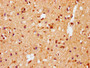 IHC image of CAC12497 diluted at 1:100 and staining in paraffin-embedded human brain tissue performed on a Leica BondTM system. After dewaxing and hydration, antigen retrieval was mediated by high pressure in a citrate buffer (pH 6.0). Section was blocked with 10% normal goat serum 30min at RT. Then primary antibody (1% BSA) was incubated at 4? overnight. The primary is detected by a biotinylated secondary antibody and visualized using an HRP conjugated SP system.