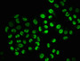 Immunofluorescence staining of Hela cells(treated with 100mM EGF for 20min) with CAC12497 at 1:206,counter-stained with DAPI. The cells were fixed in 4% formaldehyde, permeabilized using 0.2% Triton X-100 and blocked in 10% normal Goat Serum. The cells were then incubated with the antibody overnight at 4?. The secondary antibody was Alexa Fluor 488-congugated AffiniPure Goat Anti-Rabbit IgG (H+L).