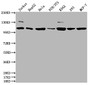 Western Blot; Positive WB detected in: Jurkat whole cell lysate, HepG2 whole cell lysate, Hela whole cell lysate, NIH/3T3 whole cell lysate, K562 whole cell lysate, 293 whole cell lysate, MCF-7 whole cell lysate; All lanes: PIK3CA antibody at 1:1500; Secondary; Goat polyclonal to rabbit IgG at 1/50000 dilution; Predicted band size: 125 kDa; Observed band size: 110 kDa