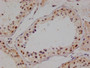 IHC image of CAC12509 diluted at 1:100 and staining in paraffin-embedded human testis tissue performed on a Leica BondTM system. After dewaxing and hydration, antigen retrieval was mediated by high pressure in a citrate buffer (pH 6.0). Section was blocked with 10% normal goat serum 30min at RT. Then primary antibody (1% BSA) was incubated at 4°C overnight. The primary is detected by a Goat anti-rabbit polymer IgG labeled by HRP and visualized using 0.05% DAB.