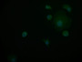 Immunofluorescence staining of MCF-7 cell at 1:50, counter-stained with DAPI. The cells were fixed in 4% formaldehyde and blocked in 10% normal Goat Serum. The cells were then incubated with the antibody overnight at 4°C. The secondary antibody was Alexa Fluor 598-congugated AffiniPure Goat Anti-Rabbit IgG(H+L).