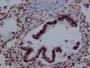 IHC image of CAC12520 diluted at 1:100 and staining in paraffin-embedded human lung tissue performed on a Leica BondTM system. After dewaxing and hydration, antigen retrieval was mediated by high pressure in a citrate buffer (pH 6.0). Section was blocked with 10% normal goat serum 30min at RT. Then primary antibody (1% BSA) was incubated at 4°C overnight. The primary is detected by a Goat anti-rabbit polymer IgG labeled by HRP and visualized using 0.05% DAB.