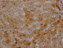 IHC image of CAC12521 diluted at 1:100 and staining in paraffin-embedded human liver tissue performed on a Leica BondTM system. After dewaxing and hydration, antigen retrieval was mediated by high pressure in a citrate buffer (pH 6.0). Section was blocked with 10% normal goat serum 30min at RT. Then primary antibody (1% BSA) was incubated at 4? overnight. The primary is detected by a Goat anti-rabbit IgG polymer labeled by HRP and visualized using 0.05% DAB.