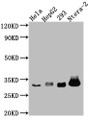 Western Blot; Positive WB detected in: Hela whole cell lysate, HepG2 whole cell lysate, HEK293 whole cell lysate, Ntera-2 whole cell lysate; All lanes: pro Caspase 3 antibody at 1:1000; Secondary; Goat polyclonal to rabbit IgG at 1/50000 dilution; Predicted band size: 32 kDa; Observed band size: 32 kDa