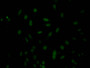 Immunofluorescence staining of Hela Cells with CAC12526 at 1:50, counter-stained with DAPI. The cells were fixed in 4% formaldehyde, permeated by 0.2% TritonX-100, and blocked in 10% normal Goat Serum. The cells were then incubated with the antibody overnight at 4?. Nuclear DNA was labeled in blue with DAPI. The secondary antibody was FITC-conjugated AffiniPure Goat Anti-Rabbit IgG (H+L).