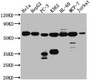 Western Blot; Positive WB detected in: Hela whole cell lysate, HepG2 whole cell lysate, PC-3 whole cell lysate, K562 whole cell lysate, HL-60 whole cell lysate, MCF-7 whole cell lysate, Jurkat whole cell lysate; All lanes: PTBP1 antibody at 1:1000; Secondary; Goat polyclonal to rabbit IgG at 1/50000 dilution; Predicted band size: 58, 60, 60 kDa; Observed band size: 58 kDa