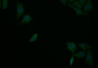 Immunofluorescence staining of Hela with CAC12549 at 1:25, counter-stained with DAPI. The cells were fixed in 4% formaldehyde and blocked in 10% normal Goat Serum. The cells were then incubated with the antibody overnight at 4°C. The secondary antibody was Alexa Fluor 507-congugated AffiniPure Goat Anti-Rabbit IgG(H+L).