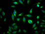 Immunofluorescence staining of Hela Cells with CAC12552 at 1:50, counter-stained with DAPI. The cells were fixed in 4% formaldehyde, permeated by 0.2% TritonX-100, and blocked in 10% normal Goat Serum. The cells were then incubated with the antibody overnight at 4?. Nuclear DNA was labeled in blue with DAPI. The secondary antibody was FITC-conjugated AffiniPure Goat Anti-Rabbit IgG (H+L).