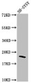 Western Blot; Positive WB detected in: SH-SY5Y whole cell lysate; All lanes: Rho antibody at 1:1500; Secondary; Goat polyclonal to rabbit IgG at 1/50000 dilution; Predicted band size: 22 kDa; Observed band size: 22 kDa