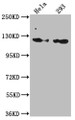 Western Blot; Positive WB detected in: Hela whole cell lysate, 293 whole cell lysate; All lanes: RNF20 antibody at 1:1000; Secondary; Goat polyclonal to rabbit IgG at 1/50000 dilution; Predicted band size: 114 kDa; Observed band size: 114 kDa