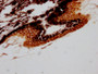 IHC image of CAC12558 diluted at 1:100 and staining in paraffin-embedded human eye tissue performed on a Leica BondTM system. After dewaxing and hydration, antigen retrieval was mediated by high pressure in a citrate buffer (pH 6.0). Section was blocked with 10% normal goat serum 30min at RT. Then primary antibody (1% BSA) was incubated at 4? overnight. The primary is detected by a Goat anti-rabbit IgG polymer labeled by HRP and visualized using 0.05% DAB.