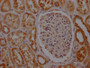 IHC image of CAC12569 diluted at 1:100 and staining in paraffin-embedded human kidney tissue performed on a Leica BondTM system. After dewaxing and hydration, antigen retrieval was mediated by high pressure in a citrate buffer (pH 6.0). Section was blocked with 10% normal goat serum 30min at RT. Then primary antibody (1% BSA) was incubated at 4? overnight. The primary is detected by a Goat anti-rabbit IgG polymer labeled by HRP and visualized using 0.05% DAB.