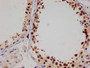 IHC image of CAC12570 diluted at 1:100 and staining in paraffin-embedded human testis tissue performed on a Leica BondTM system. After dewaxing and hydration, antigen retrieval was mediated by high pressure in a citrate buffer (pH 6.0). Section was blocked with 10% normal goat serum 30min at RT. Then primary antibody (1% BSA) was incubated at 4°C overnight. The primary is detected by a Goat anti-rabbit polymer IgG labeled by HRP and visualized using 0.05% DAB.