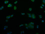 Immunofluorescence staining of PC-3 cell with CAC12570 at 1:50, counter-stained with DAPI. The cells were fixed in 4% formaldehyde and blocked in 10% normal Goat Serum. The cells were then incubated with the antibody overnight at 4°C. The secondary antibody was Alexa Fluor 527-congugated AffiniPure Goat Anti-Rabbit IgG(H+L).