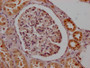 IHC image of CAC12589 diluted at 1:100 and staining in paraffin-embedded human kidney tissue performed on a Leica BondTM system. After dewaxing and hydration, antigen retrieval was mediated by high pressure in a citrate buffer (pH 6.0). Section was blocked with 10% normal goat serum 30min at RT. Then primary antibody (1% BSA) was incubated at 4? overnight. The primary is detected by a Goat anti-rabbit IgG polymer labeled by HRP and visualized using 0.05% DAB.