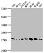Western Blot; Positive WB detected in: 293 whole cell lysate, Hela whole cell lysate, Jurkat whole cell lysate, MCF-7 whole cell lysate, K562 whole cell lysate, HepG2 whole cell lysate, U87 whole cell lysate; All lanes: SOD1 antibody at 1:1500; Secondary; Goat polyclonal to rabbit IgG at 1/50000 dilution; Predicted band size: 16 kDa; Observed band size: 18 kDa
