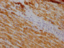 IHC image of CAC12593 diluted at 1:100 and staining in paraffin-embedded human liver cancer performed on a Leica BondTM system. After dewaxing and hydration, antigen retrieval was mediated by high pressure in a citrate buffer (pH 6.0). Section was blocked with 10% normal goat serum 30min at RT. Then primary antibody (1% BSA) was incubated at 4? overnight. The primary is detected by a Goat anti-rabbit IgG polymer labeled by HRP and visualized using 0.05% DAB.
