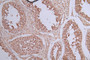 IHC image of CAC12602 diluted at 1:50 and staining in paraffin-embedded human testis tissue performed on a Leica BondTM system. After dewaxing and hydration, antigen retrieval was mediated by high pressure in a citrate buffer (pH 6.0). Section was blocked with 10% normal goat serum 30min at RT. Then primary antibody (1% BSA) was incubated at 4°C overnight. The primary is detected by a Goat anti-rabbit polymer IgG labeled by HRP and visualized using 0.40% DAB.