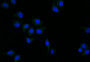 Immunofluorescence staining of Hela with CAC12602 at 1:25, counter-stained with DAPI. The cells were fixed in 4% formaldehyde and blocked in 10% normal Goat Serum. The cells were then incubated with the antibody overnight at 4°C. The secondary antibody was Alexa Fluor 508-congugated AffiniPure Goat Anti-Rabbit IgG(H+L).