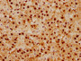 IHC image of CAC12611 diluted at 1:92.5 and staining in paraffin-embedded human adrenal gland tissue performed on a Leica BondTM system. After dewaxing and hydration, antigen retrieval was mediated by high pressure in a citrate buffer (pH 6.0). Section was blocked with 10% normal goat serum 30min at RT. Then primary antibody (1% BSA) was incubated at 4? overnight. The primary is detected by a biotinylated secondary antibody and visualized using an HRP conjugated SP system.