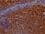 IHC image of CAC12612 diluted at 1:100 and staining in paraffin-embedded human tonsil tissue performed on a Leica BondTM system. After dewaxing and hydration, antigen retrieval was mediated by high pressure in a citrate buffer (pH 6.0). Section was blocked with 10% normal goat serum 30min at RT. Then primary antibody (1% BSA) was incubated at 4? overnight. The primary is detected by a Goat anti-rabbit IgG polymer labeled by HRP and visualized using 0.05% DAB.