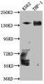 Western Blot; Positive WB detected in: K562 whole cell lysate, THP-1 whole cell lysate; All lanes: TACC3 Antibody at 1:1000; Secondary; Goat polyclonal to rabbit IgG at 1/50000 dilution; Predicted band size: 91 kDa; Observed band size: 140 kDa