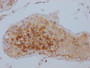 IHC image of CAC12614 diluted at 1:100 and staining in paraffin-embedded human testis tissue performed on a Leica BondTM system. After dewaxing and hydration, antigen retrieval was mediated by high pressure in a citrate buffer (pH 6.0). Section was blocked with 10% normal goat serum 30min at RT. Then primary antibody (1% BSA) was incubated at 4? overnight. The primary is detected by a Goat anti-rabbit IgG polymer labeled by HRP and visualized using 0.05% DAB.