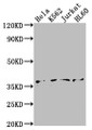 Western Blot; Positive WB detected in: Hela whole cell lysate, K562 whole cell lysate, Jurkat whole cell lysate, HL60 whole cell lysate; All lanes: TBP antibody at 1:2000; Secondary; Goat polyclonal to rabbit IgG at 1/50000 dilution; Predicted band size: 38, 36 kDa; Observed band size: 36 kDa