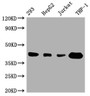 Western Blot; Positive WB detected in: 293 whole cell lysate, HepG2 whole cell lysate, Jurkat whole cell lysate, THP-1 whole cell lysate; All lanes: TMEM173 antibody at 1:1000; Secondary; Goat polyclonal to rabbit IgG at 1/50000 dilution; Predicted band size: 43 kDa; Observed band size: 43 kDa