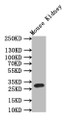 Western Blot; Positive WB detected in: Mouse Kidney tissue lysate,; All lanes: Mast Cell Tryptase antibody at 1:1000; Secondary; Goat polyclonal to rabbit IgG at 1/50000 dilution; Predicted band size: 30 kDa; Observed band size: 30 kDa