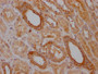 IHC image of CAC12637 diluted at 1:100 and staining in paraffin-embedded human kidney tissue performed on a Leica BondTM system. After dewaxing and hydration, antigen retrieval was mediated by high pressure in a citrate buffer (pH 6.0). Section was blocked with 10% normal goat serum 30min at RT. Then primary antibody (1% BSA) was incubated at 4? overnight. The primary is detected by a Goat anti-rabbit IgG polymer labeled by HRP and visualized using 0.05% DAB.