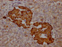 IHC image of CAC12643 diluted at 1:100 and staining in paraffin-embedded human pancreatic tissue performed on a Leica BondTM system. After dewaxing and hydration, antigen retrieval was mediated by high pressure in a citrate buffer (pH 6.0). Section was blocked with 10% normal goat serum 30min at RT. Then primary antibody (1% BSA) was incubated at 4? overnight. The primary is detected by a Goat anti-rabbit IgG polymer labeled by HRP and visualized using 0.05% DAB.