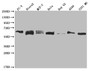 Western Blot; Positive WB detected in: PC3 whole cell lysate, Ntera-2 whole cell lysate, MCF-7 whole cell lysate, Hela whole cell lysate, HepG2 whole cell lysate, A549 whole cell lysate, U251 whole cell lysate; All lanes: USP14 antibody at 1:2000; Secondary; Goat polyclonal to rabbit IgG at 1/50000 dilution; Predicted band size: 57, 53, 55 kDa; Observed band size: 55-72 kDa