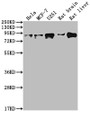 Western Blot; Positive WB detected in: Hela whole cell lysate, MCF-7 whole cell lysate, U251 whole cell lysate, Rat brain tissue, Rat liver tissue; All lanes: VCP antibody at 1:2000; Secondary; Goat polyclonal to rabbit IgG at 1/50000 dilution; Predicted band size: 90 kDa; Observed band size: 90 kDa