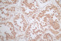 IHC image of CAC12655 diluted at 1:50 and staining in paraffin-embedded human testis tissue performed on a Leica BondTM system. After dewaxing and hydration, antigen retrieval was mediated by high pressure in a citrate buffer (pH 6.0). Section was blocked with 10% normal goat serum 30min at RT. Then primary antibody (1% BSA) was incubated at 4°C overnight. The primary is detected by a Goat anti-rabbit polymer IgG labeled by HRP and visualized using 0.79% DAB.