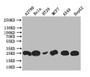 Western Blot; Positive WB detected in: HT29 whole cell lysate, Hela whole cell lysate, HT29 whole cell lysate, MCF7 whole cell lysate, A549 whole cell lysate, HEPG2 whole cell lysate; All lanes: HE4 antibody at 1:1000; Secondary; Goat polyclonal to rabbit IgG at 1/50000 dilution; Predicted band size: 25 kDa; Observed band size: 25 kDa