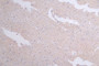 IHC image diluted at 1:50 and staining in paraffin-embedded human brain tissue performed on a Leica BondTM system. After dewaxing and hydration, antigen retrieval was mediated by high pressure in a citrate buffer (pH 6.0). Section was blocked with 10% normal goat serum 30min at RT. Then primary antibody (1% BSA) was incubated at 4°C overnight. The primary is detected by a Goat anti-rabbit polymer IgG labeled by HRP and visualized using 0.60% DAB.
