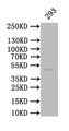 Western Blot; Positive WB detected in: 293 whole cell lysate; All lanes: CALR antibody at 1:1000; Secondary; Goat polyclonal to mouse IgG at 1/50000 dilution; Predicted band size: 49 kDa; Observed band size: 49 kDa