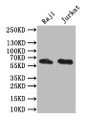 Western Blot; Positive WB detected in: Raji whole cell lysate, JK whole cell lysate; All lanes: CD19 antibody at 1:1000; Secondary; Goat polyclonal to mouse IgG at 1/50000 dilution; Predicted band size: 62 kDa; Observed band size: 62 kDa