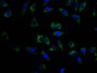 Immunofluorescence staining of MCF7 cell with CAC12693 at 1:150, counter-stained with DAPI. The cells were fixed in 4% formaldehyde and blocked in 10% normal Goat Serum. The cells were then incubated with the antibody overnight at 4C. The secondary antibody was FITC-conjugated AffiniPure Goat Anti-human IgG(H+L).