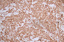 IHC image of CAC12717 diluted at 1:50 and staining in paraffin-embedded human liver tissue performed on a Leica BondTM system. After dewaxing and hydration, antigen retrieval was mediated by high pressure in a citrate buffer (pH 6.0). Section was blocked with 10% normal goat serum 30min at RT. Then primary antibody (1% BSA) was incubated at 4°C overnight. The primary is detected by a Goat anti-Mouse IgG labeled by HRP and visualized using 0.05% DAB.