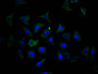 Immunofluorescence staining of MCF7 cell with CAC12752 at 1:150, counter-stained with DAPI. The cells were fixed in 4% formaldehyde and blocked in 10% normal Goat Serum. The cells were then incubated with the antibody overnight at 4C. The secondary antibody was FITC-conjugated AffiniPure Goat Anti-Mouse IgG(H+L).