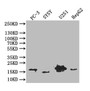 Western Blot; Positive WB detected in: PC-3 whole cell lysate, SY5Y whole cell lysate, U251 whole cell lysate, HepG2 whole cell lysate; All lanes: PDPN antibody at 1:1000; Secondary; Goat polyclonal to mouse IgG at 1/50000 dilution; Predicted band size: 17 kDa; Observed band size: 17 kDa