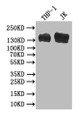 Western Blot; Positive WB detected in: THP-1 whole cell lysate, JK whole cell lysate; All lanes: PECAM1 antibody at 1:500; Secondary; Goat polyclonal to mouse IgG at 1/50000 dilution; Predicted band size: 82-140 kDa; Observed band size: 140 kDa
