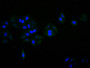 Immunofluorescence staining of SH-SY5Y cell with CAC12774 at 1:30, counter-stained with DAPI. The cells were fixed in 4% formaldehyde and blocked in 10% normal Goat Serum. The cells were then incubated with the antibody overnight at 4C. The secondary antibody was FITC-conjugated AffiniPure Goat Anti-Mouse IgG(H+L).