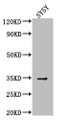 Western Blot; Positive WB detected in: SH-SY5Y whole cell lysate; All lanes: VASH2 antibody at 1:2000; Secondary; Goat polyclonal to rabbit IgG at 1/50000 dilution; Predicted band size: 41, 34, 19, 36, 30 kDa; Observed band size: 34 kDa